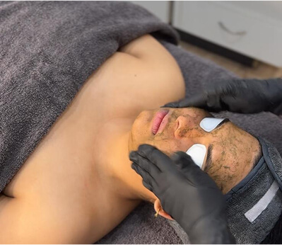 Bio-Microneedling Treatments