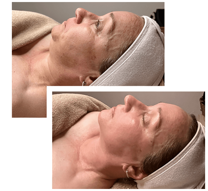 Achieve Optimum Skin Health