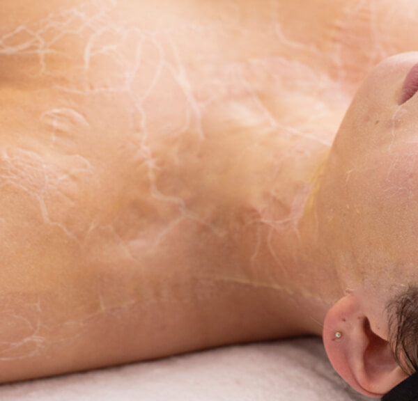 Lymphatic Drainage Facial