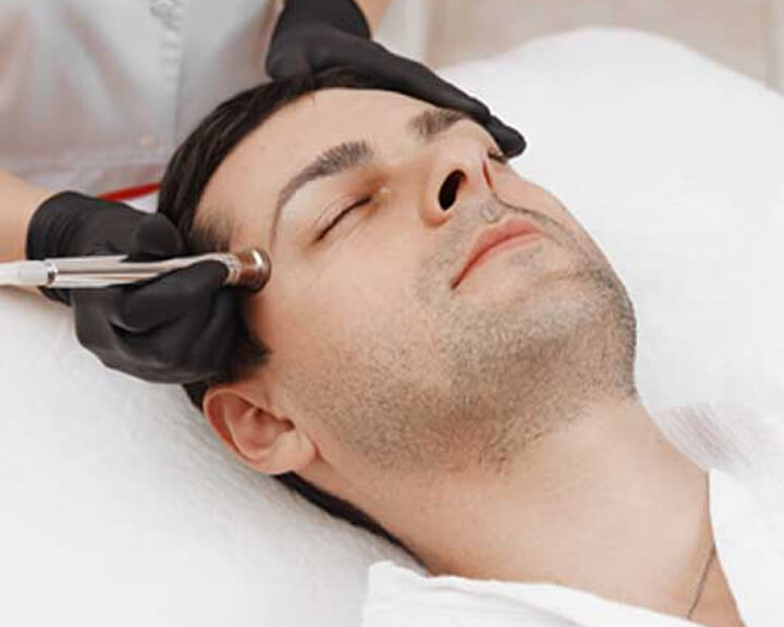 Microdermabrasion Facial