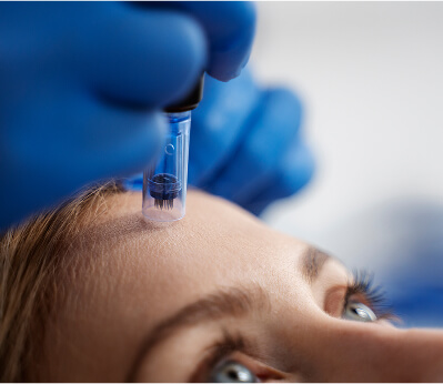 Microneedling Treatments