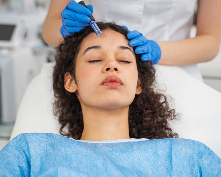 About Microneedling Treatments